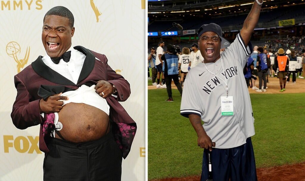 Tracy Morgan before and after
