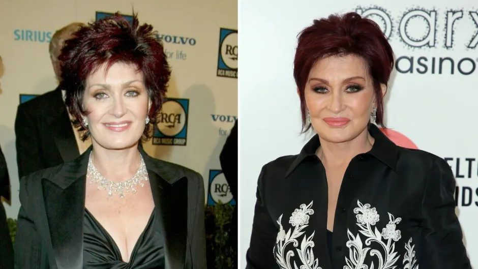  Sharon Osbourne before and after